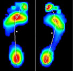 Foot-Scan