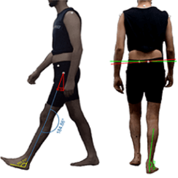 Video-gait-analysis_576x576